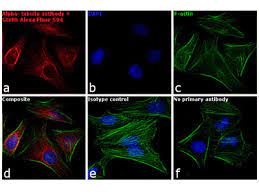 Select up to 4 products. Goat Anti Rabbit Igg H L Highly Cross Adsorbed Alexa Fluor 594 A 11037 From Thermo Fisher Scientific Biocompare Com