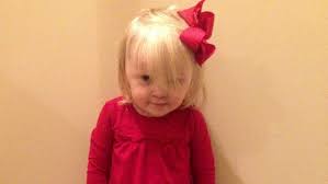 Restaurant apologizes after child with disability asked to remove shoes