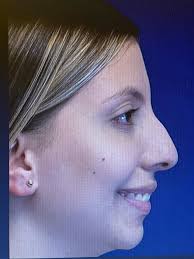 Photo posted by Dr. Mario Botero Ramirez (@marioboteroramirez)