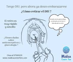 Como Se Retira El Diu Medica Center Fem