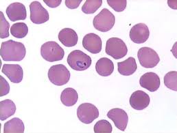 Pin By Cemre Guvercin On Lab Exam 2 Plasmodium Hematology Lab Values