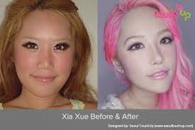 Eyelid surgery in korea is very advanced and popular. Asian Celebrities And Cosmetic Surgery Trends Part 2 Seoul Touchup Korean Plastic Surgery Clinics Trips