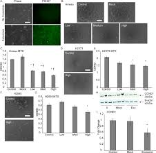 Often, constant, painful, and distressing shortness of breath drives people to seek a diagnosis. Exosomal Mir 16 5p As A Target For Malignant Mesothelioma Scientific Reports