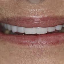 PARKHAVEN DENTAL CARE