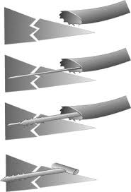 Suggest as a translation of lésion du ménisque copy Lesions Traumatiques Des Menisques Du Genou Sciencedirect