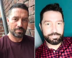 I started colouring my beard to hide my grey patches"