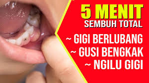Pilihan obat gusi bengkak alami. Mengatasi Gusi Bengkak Gigi Berlubang Terbukti Youtube