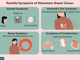 In 2020, an estimated 276,480 new cases of invasive breast cancer are. Common Symptoms Of Metastatic Breast Cancer