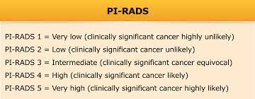 The gleason score is used to determine the grade group. The Radiology Assistant Prostate Cancer Pi Rads V2
