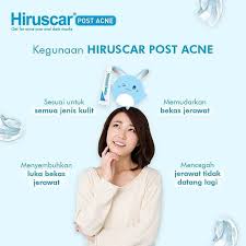 Hiruscar post acne merupakan produk keluaran dari medinova switzerland yang berguna untuk menghilangkan bekas jerawat, noda hitam, atau bekas luka di wajah. Hiruscar Post Acne Indonesia å¸–å­ Facebook