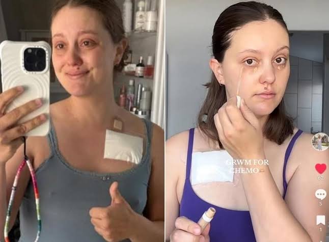 Mulher finge ter câncer de pâncreas e arrecada R$ 100 mil