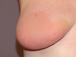 This word is used to describe how the tissue f. Here S Everything You Should Look For When Giving Yourself A Breast Exam Sheknows