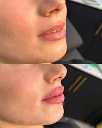 Hey guys! Looking for forward graduation, short around the face no layers.  bra trap length only ! Monday 2nd of September Times:  10am,11:15am,1:30pm,3pm Toorak Rokk Ebony Free of charge x