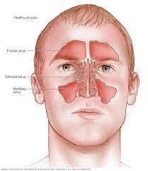 Nonallergic Rhinitis Symptoms And Causes Mayo Clinic Rhinitis Symptoms Allergic Rhinitis Symptoms