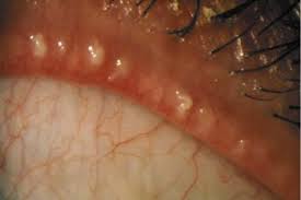 Image result for Blepharis affinis