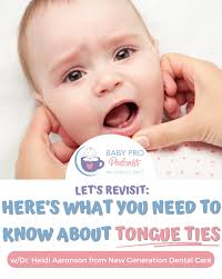 Everything You Need to Know About Tongue Ties w/Heidi Aaronson
