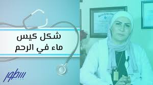 أعراض وجود كيس ماء في الرحم سطور