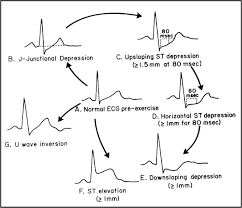 Ecg Learning Center An Introduction To Clinical Electrocardiography