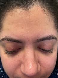 Reducing pore size for oily sensitive skin?