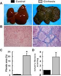Maybe you would like to learn more about one of these? Establishment Of A Liver Cirrhosis Model A Gross Appearance Of The Download Scientific Diagram