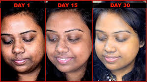 Please don't put all the above said natural remedies on your face without doing patch test first. How I Got Rid Of Pigmentation Darkness Around Mouth With Diy Serum 100 Result Within 10 Days Youtube