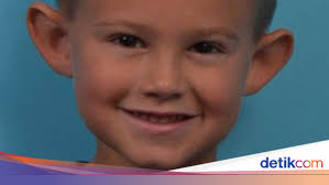 Gerah Di-bully Karena Kuping Mirip Peri, Bocah Ini Akhirnya Dioperasi