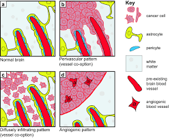 Chartered accountants firm no.af 0385. Vessel Co Option And Resistance To Anti Angiogenic Therapy Springerlink