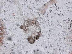 Get ready for christmas as the festive season approaches, friends. 95 Home Remedies For Scabies Ideas Home Remedies For Scabies Scabies Home Remedies