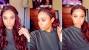 Ear To Ear Closure With Baby Hair