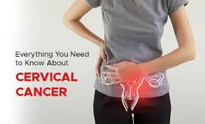 Image result for Cervical Cancer