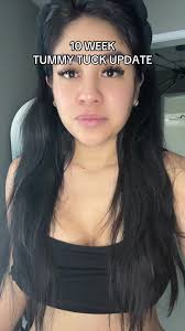 Aj Khalil Tummy Tuck