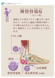 踵骨骨端症 infographics 筋肉解剖学 医療 骨格筋