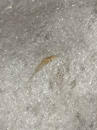 An ingrown hair near the vagina develops when the tip of a pubic hair folds back into the skin at the root. 7 Months Pregnant And Found This Buried In One Of My Stretch Marks Originally Thought It Was A Weird Ingrown Hair Until I Pulled It Out Anyone Have A Clue What It