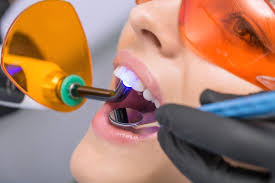 Maybe you would like to learn more about one of these? After Teeth Whitening What Can I Eat And Drink Smile World Dental Salida California