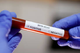 BioMérieux va fabriquer en Ariège son premier test de diagnostic ...
