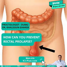 Image result for Rectal Prolapse