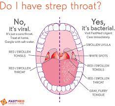 White patches at the back of your throat or on your tonsils are usually signs of infection, particularly strep throat, tonsillitis, or mononucleosis; Strep Throat What It Looks Like Bumps And White Spots In Throat