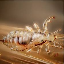 White vinegar is mostly found in every household and this particular liquid tends to be a potent lice killer as it is acetic acid. Head Lice Nits My Hair Doctor Prescription Haircare