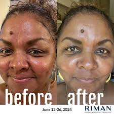 💎𝚂𝙴𝙸𝙽𝚃 𝐌𝐚𝐭𝐮𝐫𝐞-𝐒𝐤𝐢𝐧 𝙼𝙰𝙺𝙴𝚄𝙿 and Riman Skincare By  Jewel💎