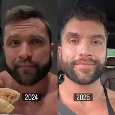 Steroids vs natural 2024 vs 2025 I'm 30 years old but in 2024 I looked 40.  If you ever needed a sign to stay away from steroids here is your sign.