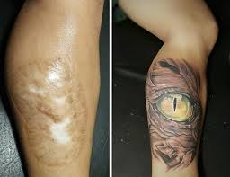 Leg tattoos designs and ideas : 211 Amazing Tattoos That Turn Scars Into Works Of Art Bored Panda