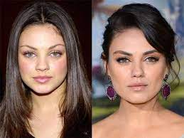 Mila'nın ailesi ukrayna'dan abd'ye taşınırken mila'ya 'sokağın yukarısına' taşınacaklarını söylemişler. Mila Kunis Before And After Haarschonheit Prominente Plastische Chirurgie Plastische Chirurgie