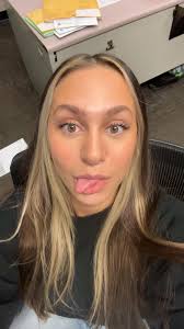 How to reduce dark circles under eyes?