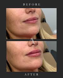 ATELIER AESTHETICS MIAMI (@atelieraestheticsmiami) · Miami, FL