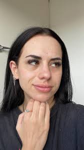 How to manage sensitive skin breakouts?