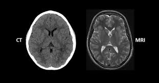According to cincinnati children's hospital and medical center, scans that. Ct Scan Vs Mri Important Things To Know For A Patient