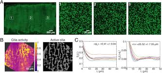 You can make the pouch, needlebook, needleminder and thread ring. Multi Scale Spatial Heterogeneity Enhances Particle Clearance In Airway Ciliary Arrays Biorxiv