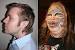 Cat Lady Plastic Surgery Before And After
