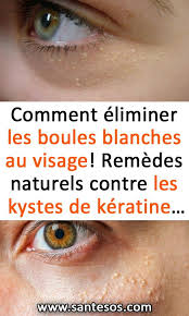 Comment Eliminer Les Boules Blanches Au Visage Remedes Naturels Contre Les Kystes De Keratine Boulesblanches Remedesnaturels Atkins Diet Hair Beauty Beauty