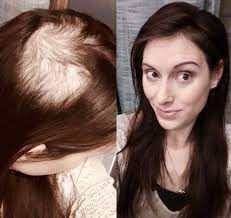 I tried to move the table, but it was too heavy. What Are The Best Hairstyles For Very Thin Hair Hair Adviser